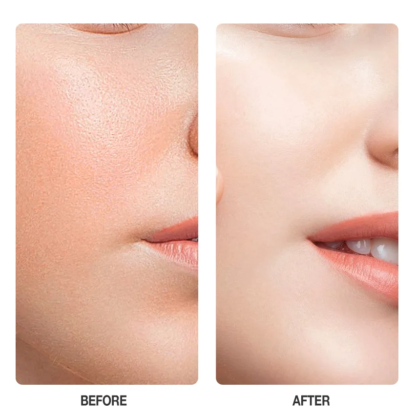 SKINEVER Water Light Serum Sunscreen 30ml [SPF 30 PA++++]