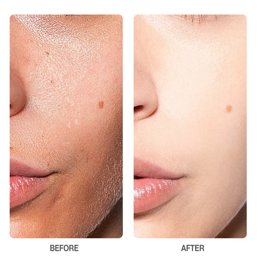 SKINEVER Salicylic Acid Refreshing Scrub Cleanser 75ml [Deep Cleansing Exfoliating Cleanser]