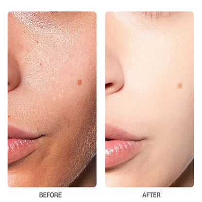 SKINEVER Salicylic Acid Refreshing Scrub Cleanser 75ml [Deep Cleansing Exfoliating Cleanser]